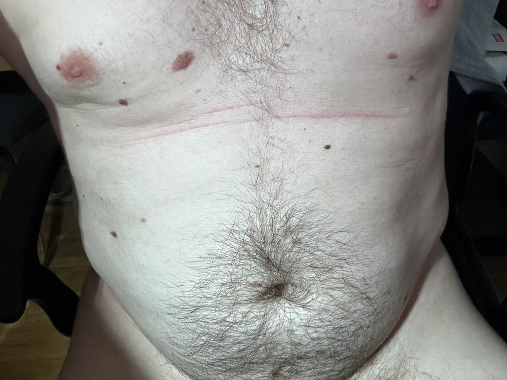 hairycockaustria