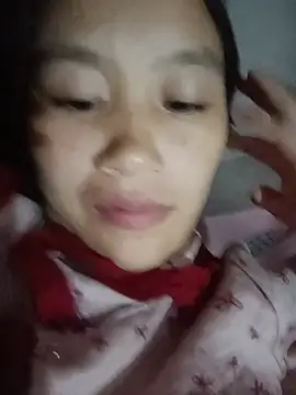 xotm