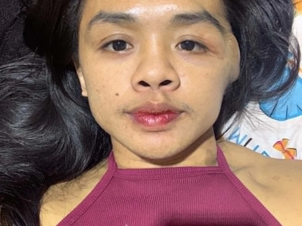 yunabigcock